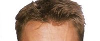 Allan McNish's hair Allan McNish's hair