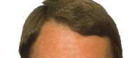 Nigel Mansell's hair Nigel Mansell's hair