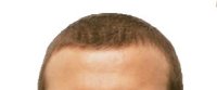 Olivier Panis's hair Olivier Panis's hair