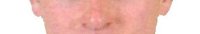 Adam Carroll's nose