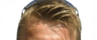 Jesper Carlsen's hair